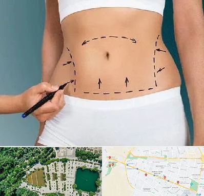 دکتر طب سنتی برای لاغری در وکیل آباد مشهد 