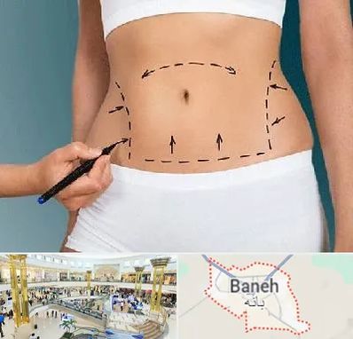 دکتر طب سنتی برای لاغری در بانه
