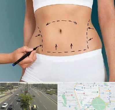 دکتر طب سنتی برای لاغری در منطقه 17 تهران 