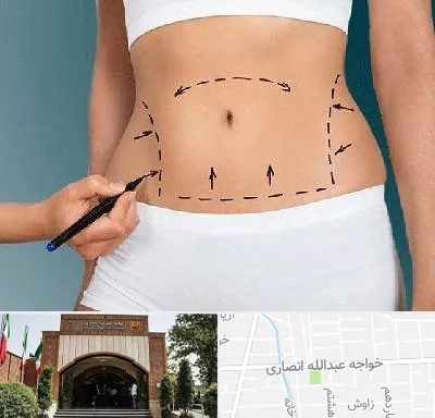 دکتر طب سنتی برای لاغری در خواجه عبدالله