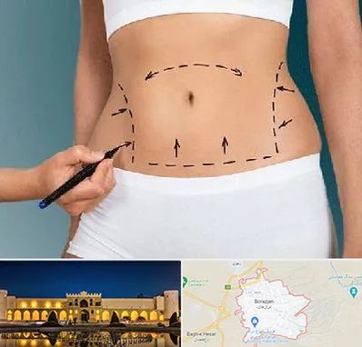 دکتر طب سنتی برای لاغری در برازجان