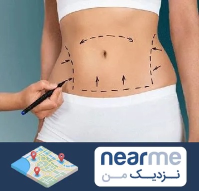 دکتر طب سنتی برای لاغری در نزدیک من