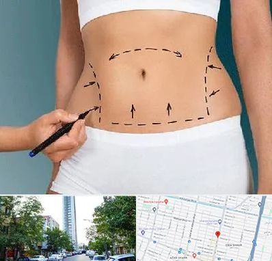 دکتر طب سنتی برای لاغری در امامت مشهد 