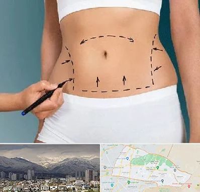 دکتر طب سنتی برای لاغری در منطقه 4 تهران 