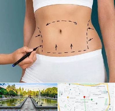 دکتر طب سنتی برای لاغری در سرسبز 