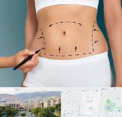 دکتر طب سنتی برای لاغری در خانی آباد 