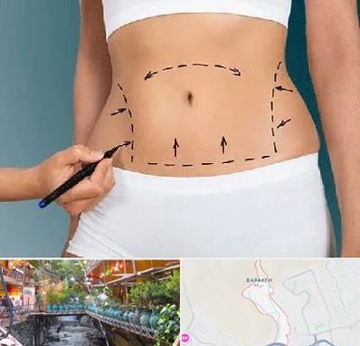 دکتر طب سنتی برای لاغری در درکه