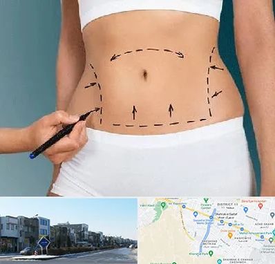 دکتر طب سنتی برای لاغری در شریعتی مشهد 