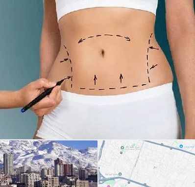 دکتر طب سنتی برای لاغری در ازگل