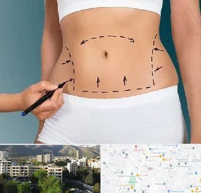 دکتر طب سنتی برای لاغری در دیباجی 