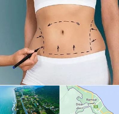 دکتر طب سنتی برای لاغری در رامسر