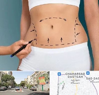 دکتر طب سنتی برای لاغری در چهارصد دستگاه 