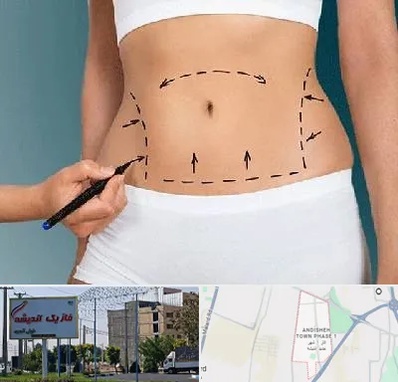 دکتر طب سنتی برای لاغری در فاز یک اندیشه