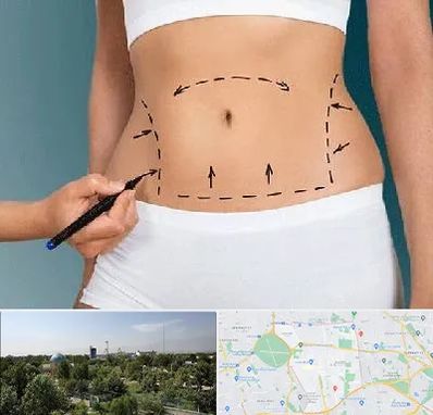 دکتر طب سنتی برای لاغری در منطقه 16 تهران 