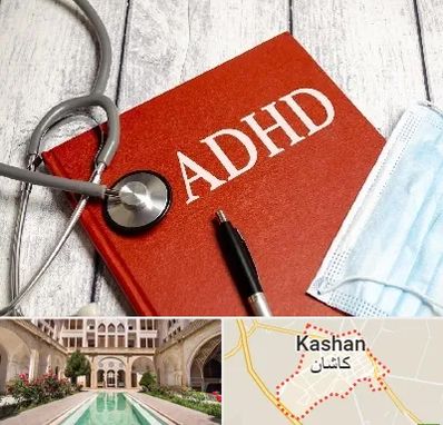 دکتر adhd (بیش فعالی بزرگسالان) در کاشان