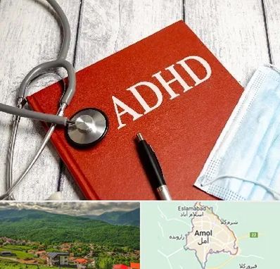دکتر adhd (بیش فعالی بزرگسالان) در آمل