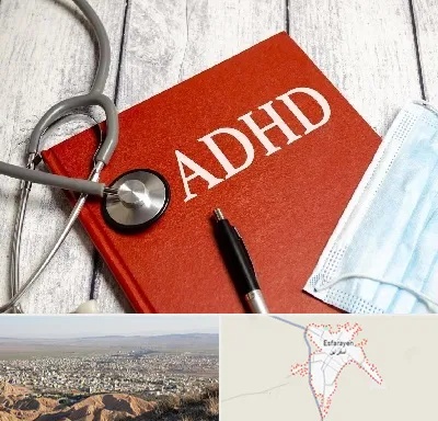 دکتر adhd (بیش فعالی بزرگسالان) در اسفراین