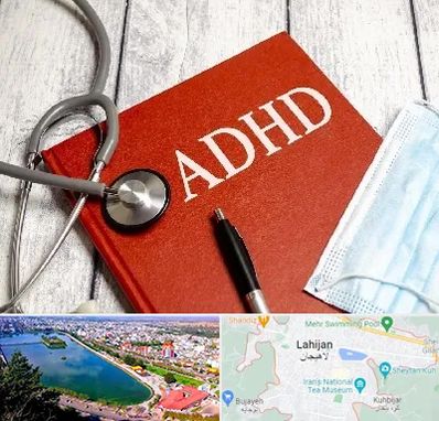 دکتر adhd (بیش فعالی بزرگسالان) در لاهیجان