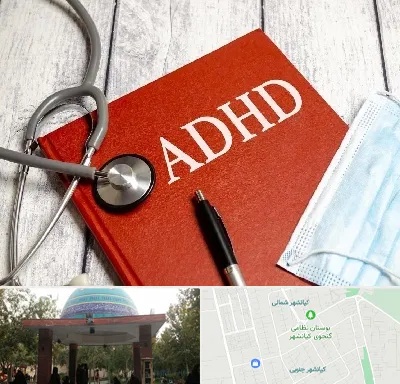 دکتر adhd (بیش فعالی بزرگسالان) در کیانشهر