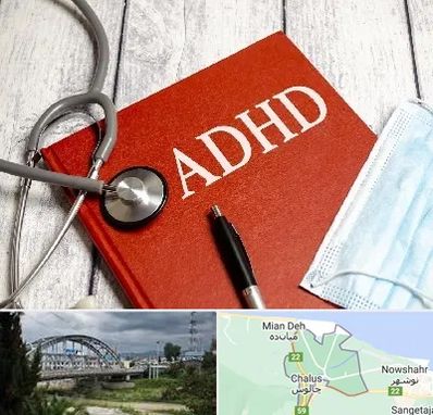 دکتر adhd (بیش فعالی بزرگسالان) در چالوس