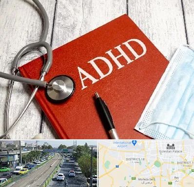 دکتر adhd (بیش فعالی بزرگسالان) در جنوب تهران 