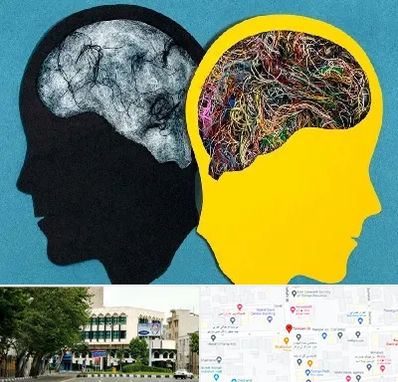 دکتر اختلال دوقطبی در طالقانی 