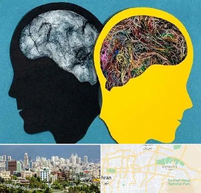 دکتر اختلال دوقطبی در شرق تهران 