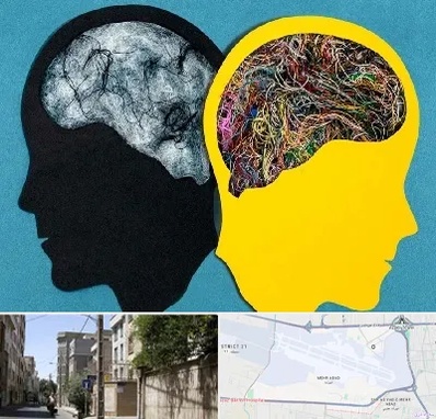 دکتر اختلال دوقطبی در مهرآباد