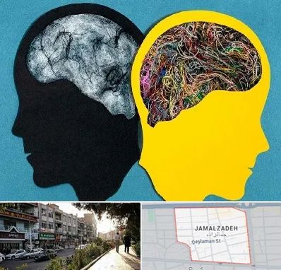 دکتر اختلال دوقطبی در خیابان جمالزاده