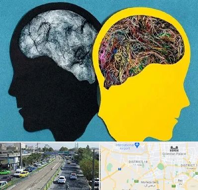 دکتر اختلال دوقطبی در جنوب تهران 