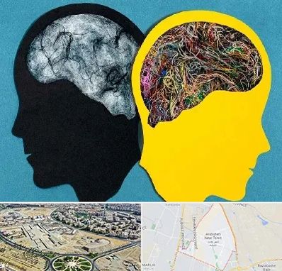 دکتر اختلال دوقطبی در اندیشه