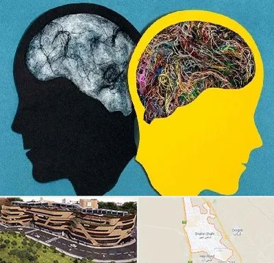 دکتر اختلال دوقطبی در شاهین شهر