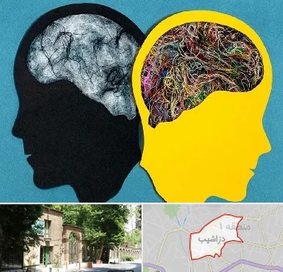 دکتر اختلال دوقطبی در دزاشیب