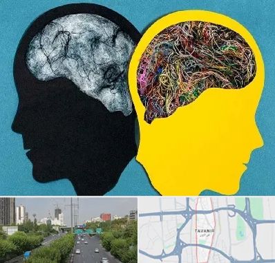 دکتر اختلال دوقطبی در توانیر