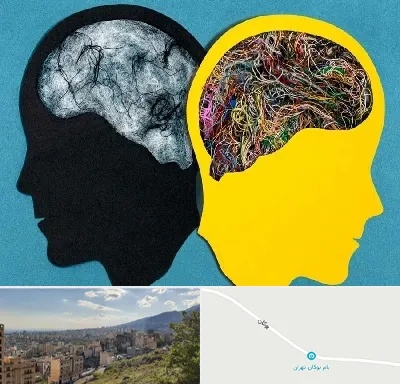دکتر اختلال دوقطبی در بوکان تهران