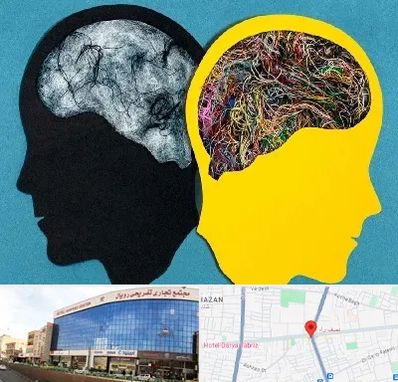 دکتر اختلال دوقطبی در نصف راه تبریز 