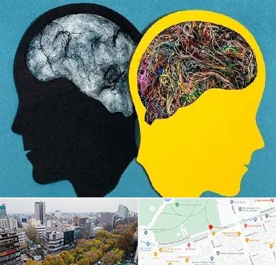 دکتر اختلال دوقطبی در بلوار کشاورز 