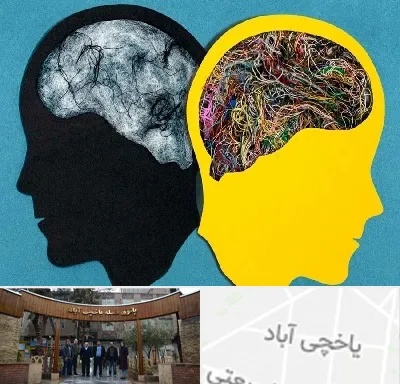 دکتر اختلال دوقطبی در یاخچی آباد