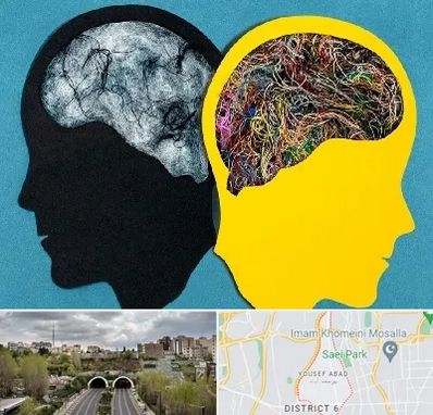 دکتر اختلال دوقطبی در یوسف آباد 