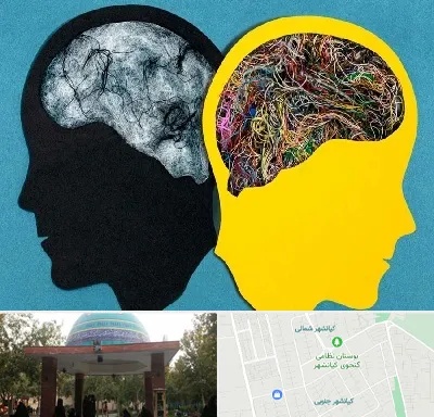 دکتر اختلال دوقطبی در کیانشهر