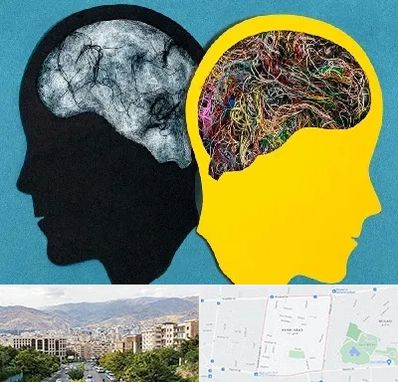 دکتر اختلال دوقطبی در خانی آباد 