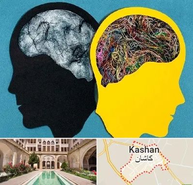 دکتر اختلال دوقطبی در کاشان