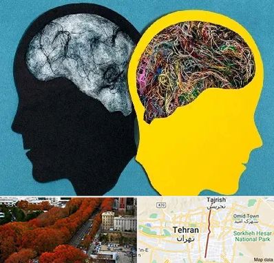 دکتر اختلال دوقطبی در ولیعصر 