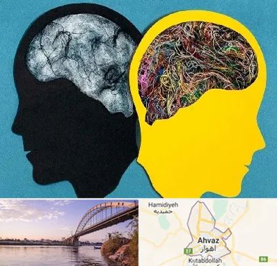 دکتر اختلال دوقطبی در اهواز