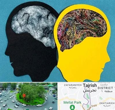 دکتر اختلال دوقطبی در تجریش 