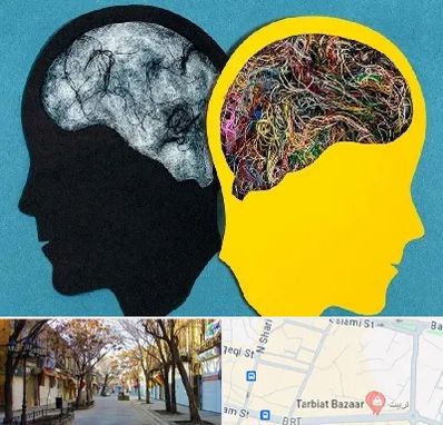 دکتر اختلال دوقطبی در تربیت تبریز 