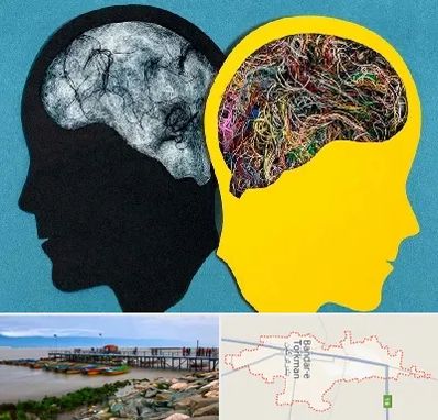 دکتر اختلال دوقطبی در بندر ترکمن