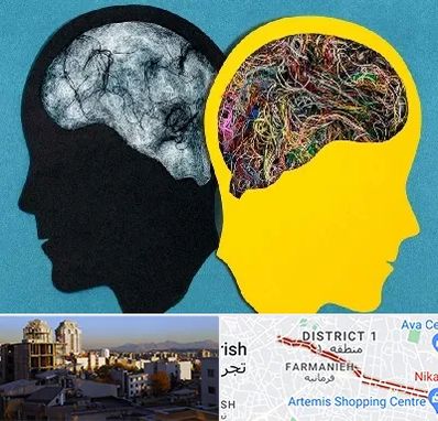 دکتر اختلال دوقطبی در فرمانیه 