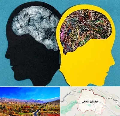 دکتر اختلال دوقطبی در خراسان شمالی