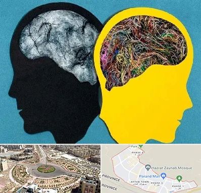 دکتر اختلال دوقطبی در پرند